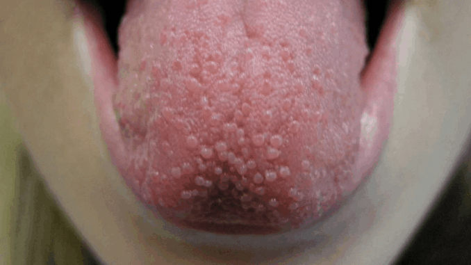 image-541-1024x575